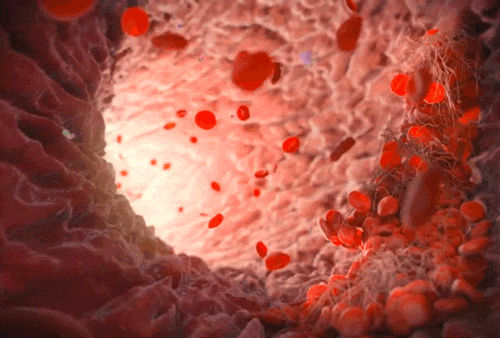 Blood-gif.gif